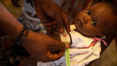 أكثر من 600 ألف طفل دون سن الخامسة معرضون للخطر بسبب انتشار الكوليرا في شمال دارفور (يونيسف)